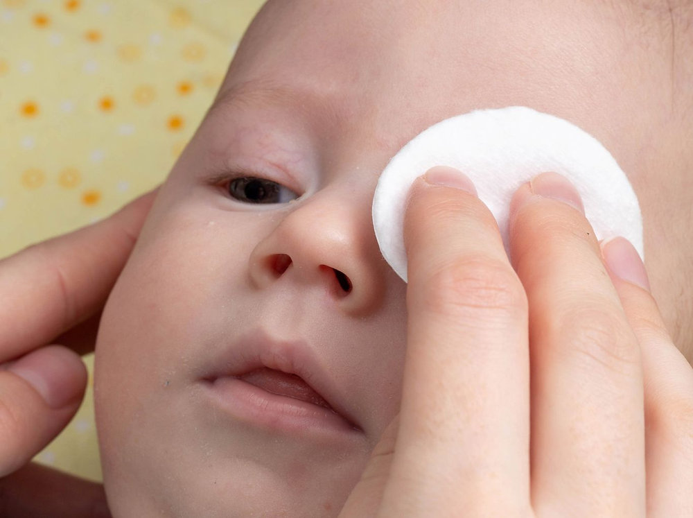 A caregiver gently wiping dried discharge from the corner of a newborn baby’s eye with a clean cotton pad in natural window light, real photograph