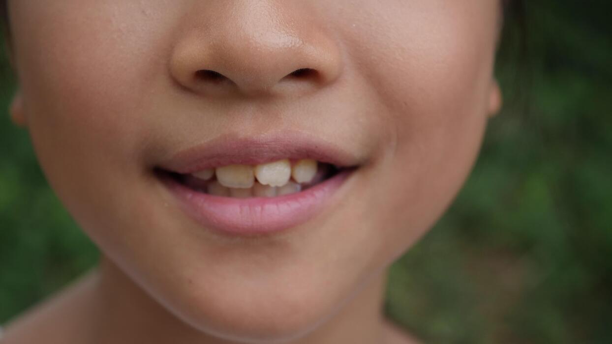 A close-up photo of a smiling elementary-aged child speaking mid-sentence, showing natural teeth and mouth movement