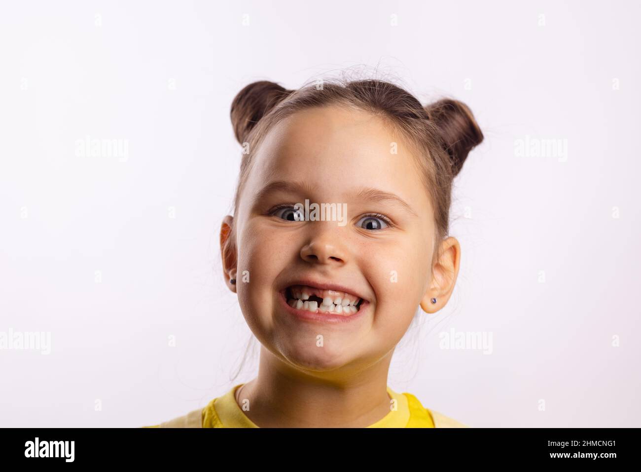 A close-up photo of a smiling toddler showing upper front baby teeth in natural indoor light, realistic photography style