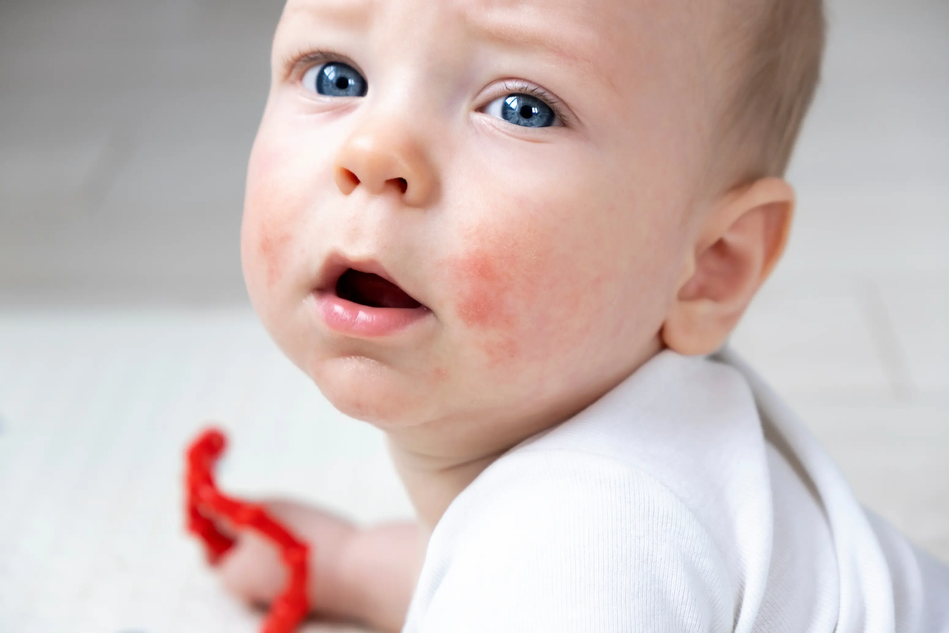 A close-up, photorealistic photograph of a baby sitting in soft window light with mild red, dry patches on the cheeks, showing natural skin texture and a calm expression