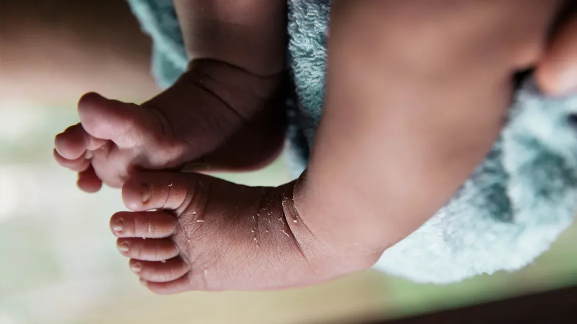 A close-up real photograph of a one-week-old newborn’s hands and feet with mild dry peeling skin around the fingers and toes, soft natural window light