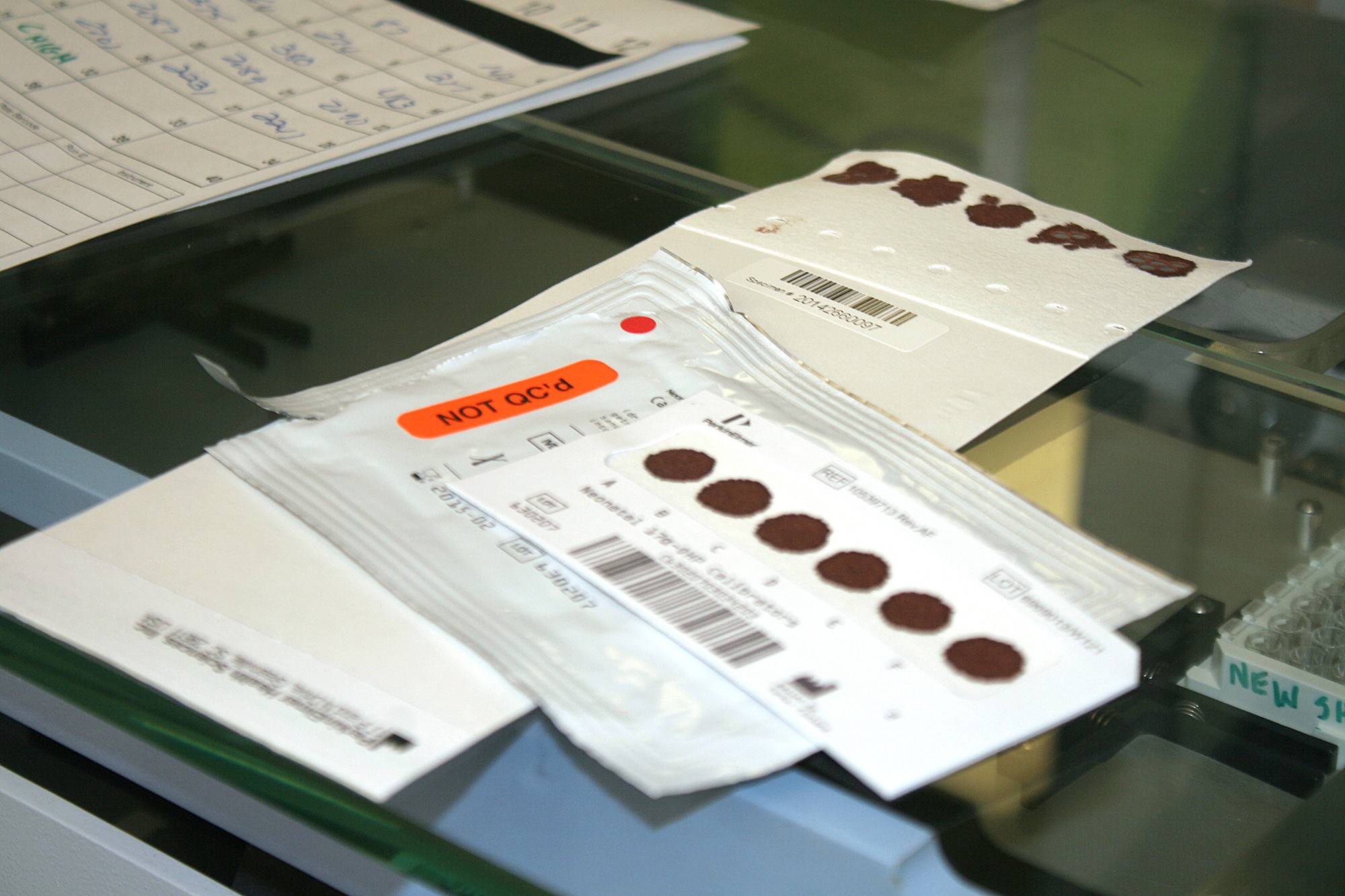 A hospital nurse holding a newborn screening blood spot card with fresh blood circles drying on a countertop in a clinical setting, documentary photo style