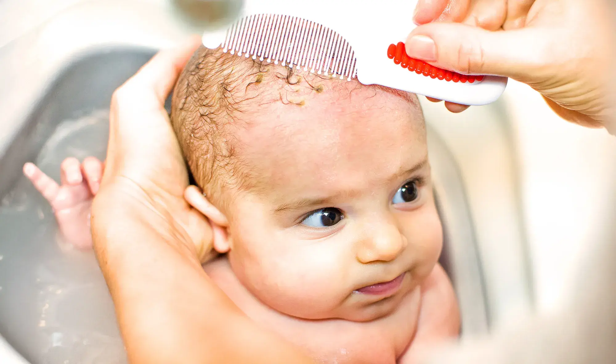 A parent gently brushing a school-age child’s hair while examining flaky scale near the hairline in a bright bathroom, candid photograph