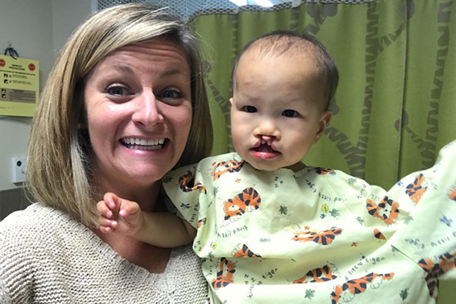A parent pressing clean gauze gently against a toddler’s lower lip to control minor bleeding after a fall, realistic photo