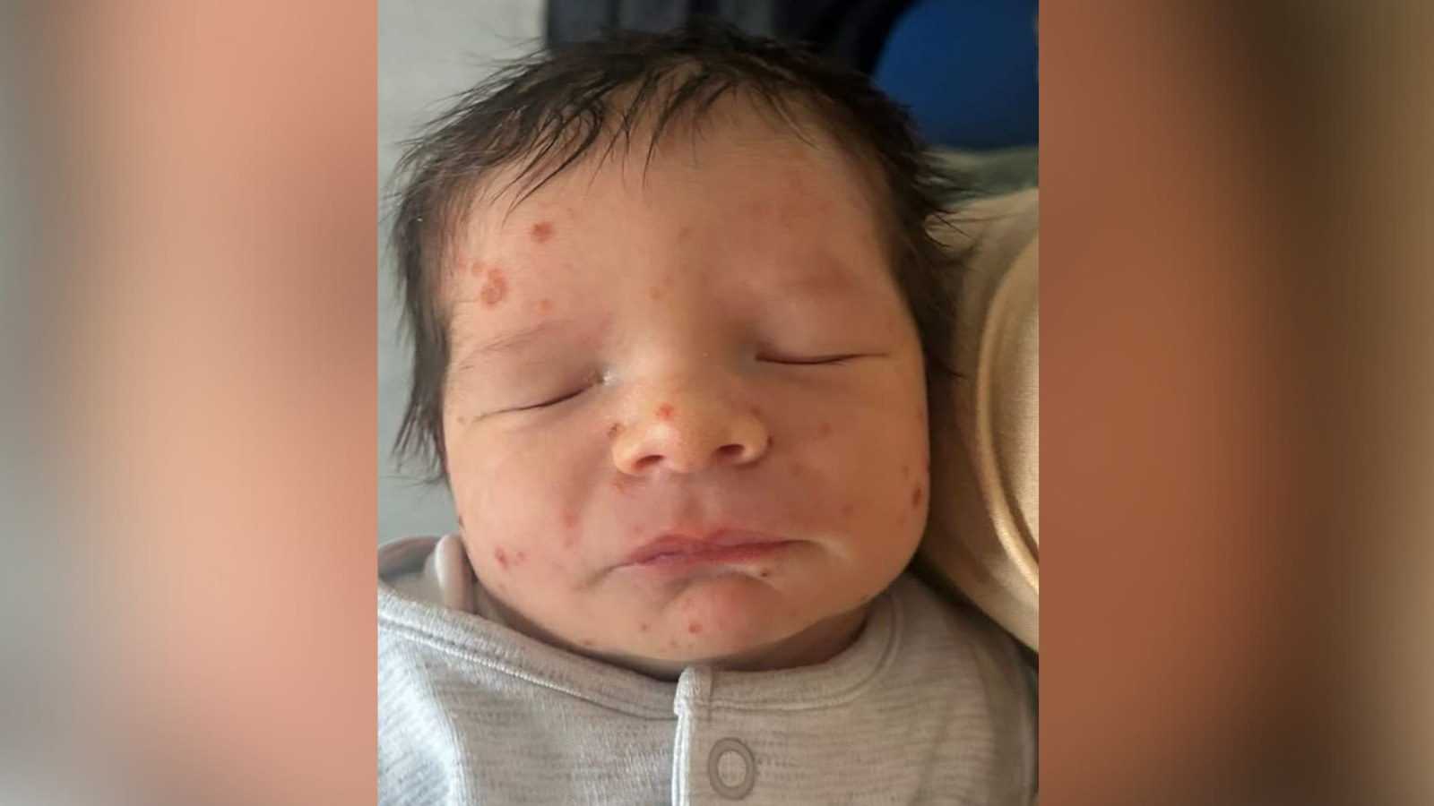 A parent using a smartphone to photograph a mild red rash on a child's forearm in a well-lit room, realistic candid photography style