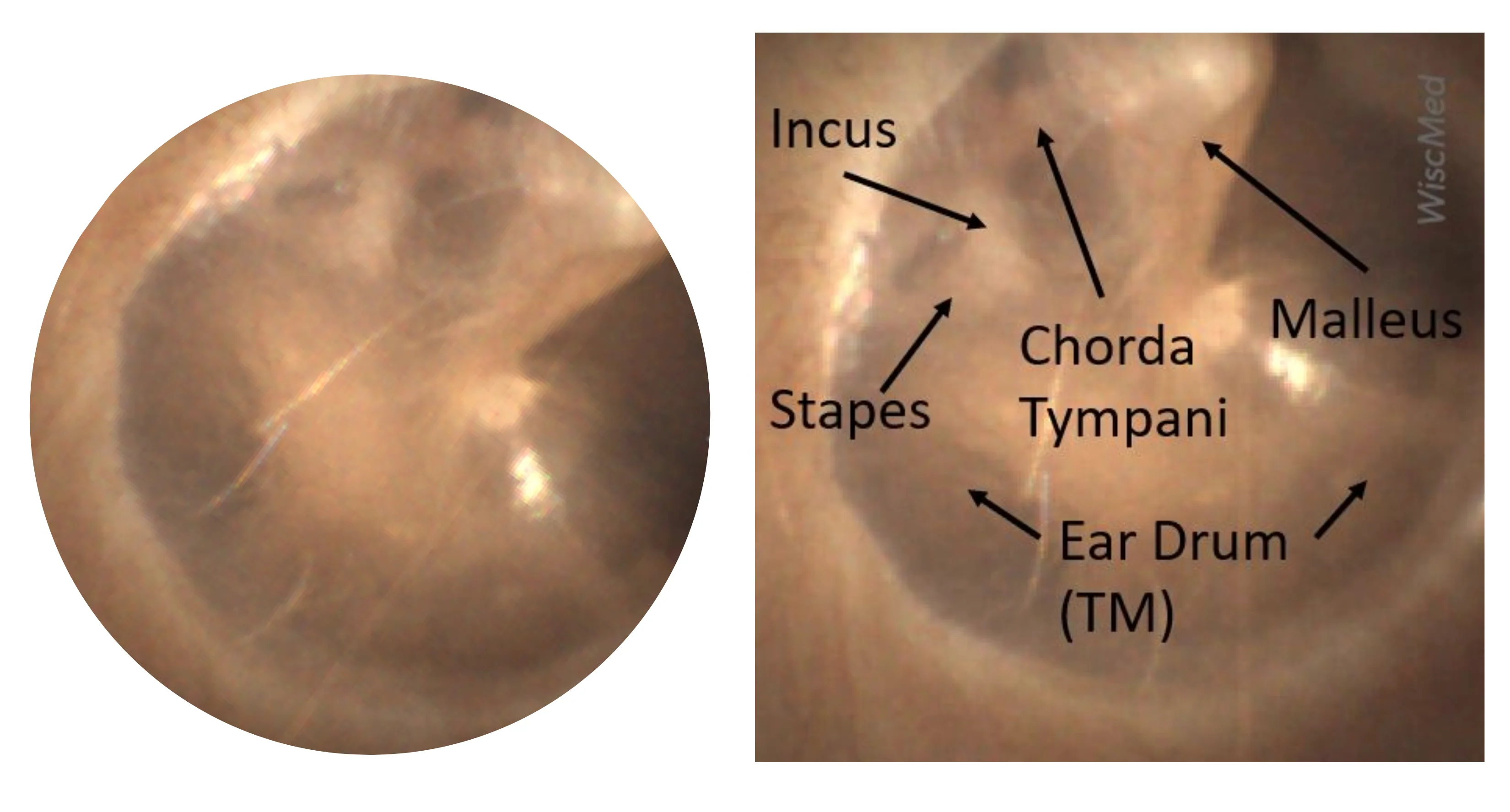 Ear Tubes for Kids: Signs, Timing, and What Surgery Is Like