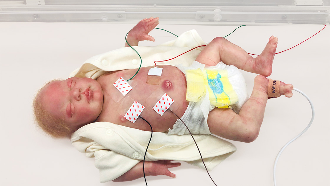 A pediatric clinician measuring a small baby’s length on an exam table while a parent watches closely, realistic clinic photography