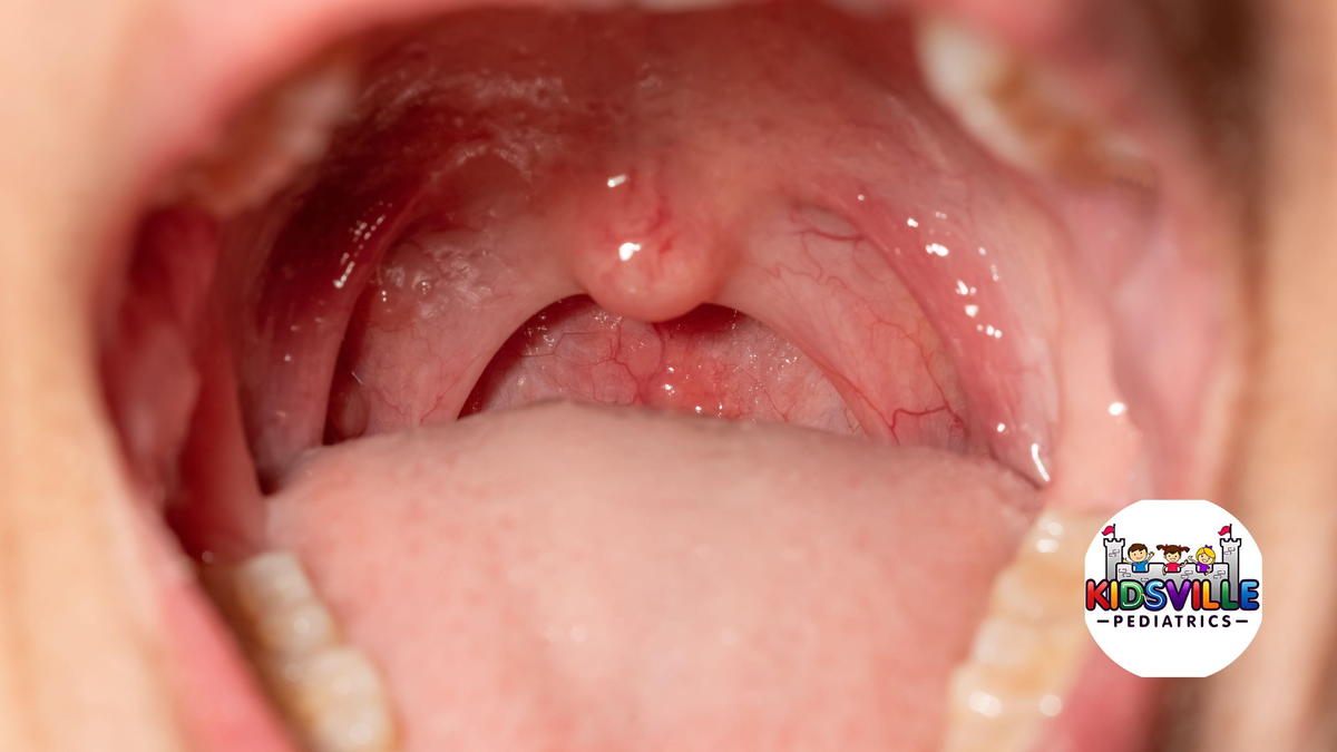 A preschool-aged child sitting on a parent’s lap with mouth open for a throat check, showing redness at the back of the throat, realistic photo