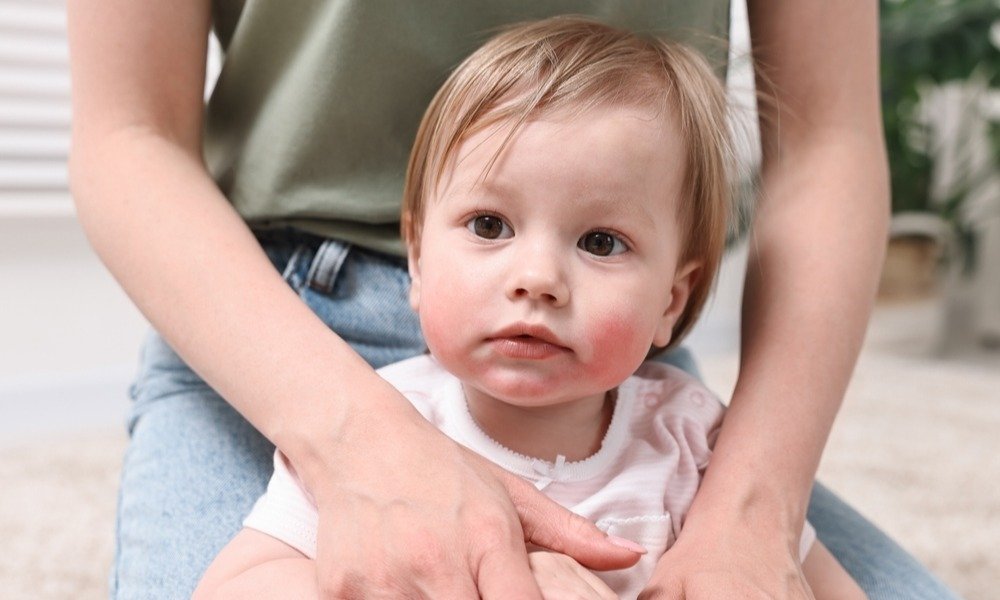 A real photo of a parent gently examining a child’s forearm under warm bedside lamp light, looking for small bumps before sleep