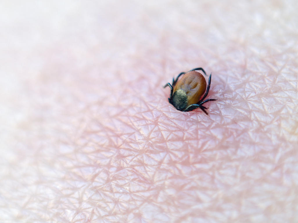 A tired parent in a softly lit bedroom gently examining a child’s forearm with a small red tick bite mark, realistic photo