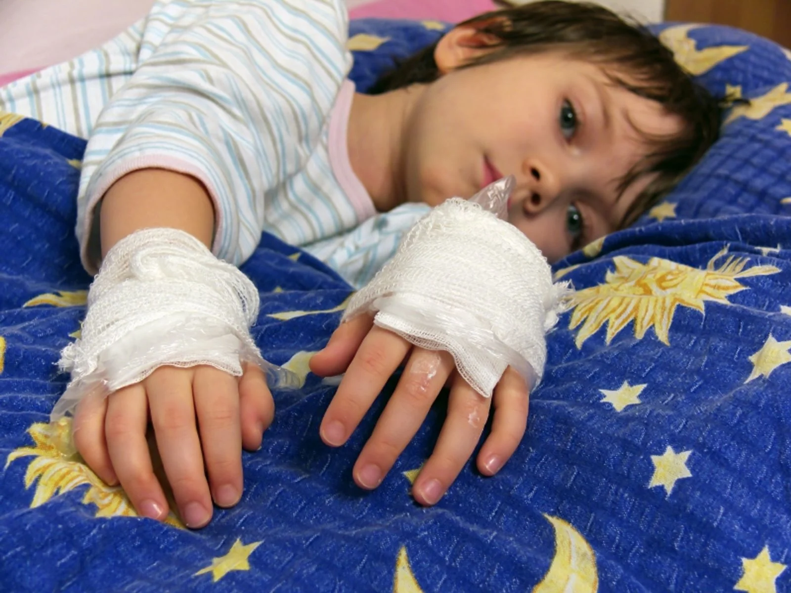 A toddler's small hand resting on a parent's lap with a loose non-stick dressing and gauze wrap applied, realistic indoor photo
